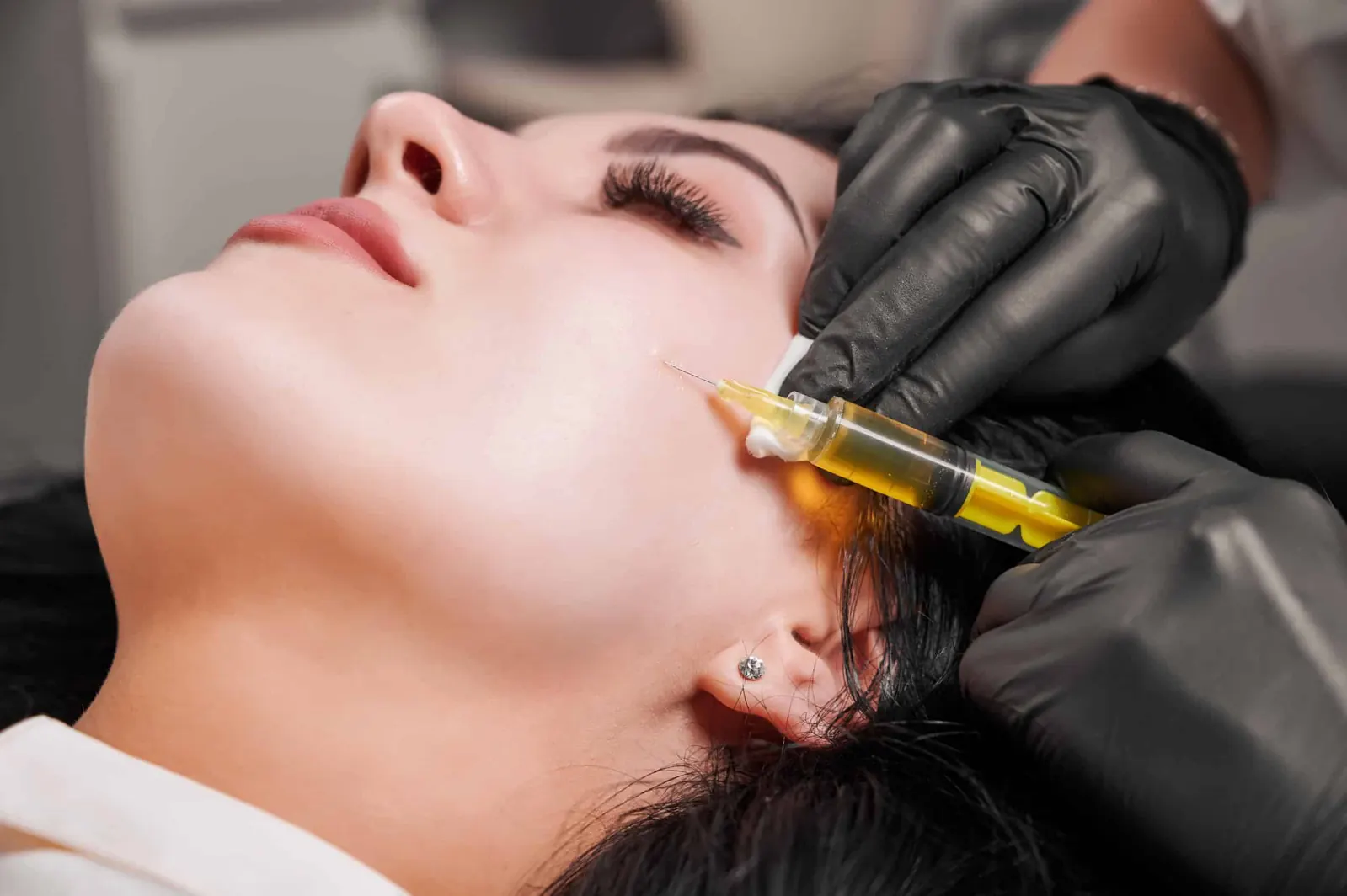 PRP Facial Treatments at NFuze Wellness