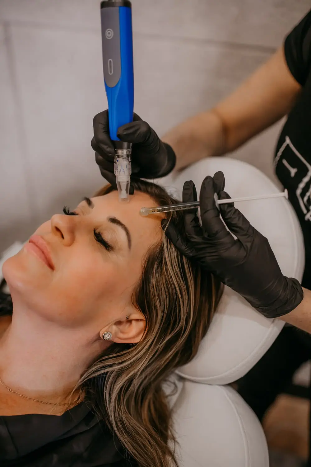 Skin treatment at NFuze Wellness