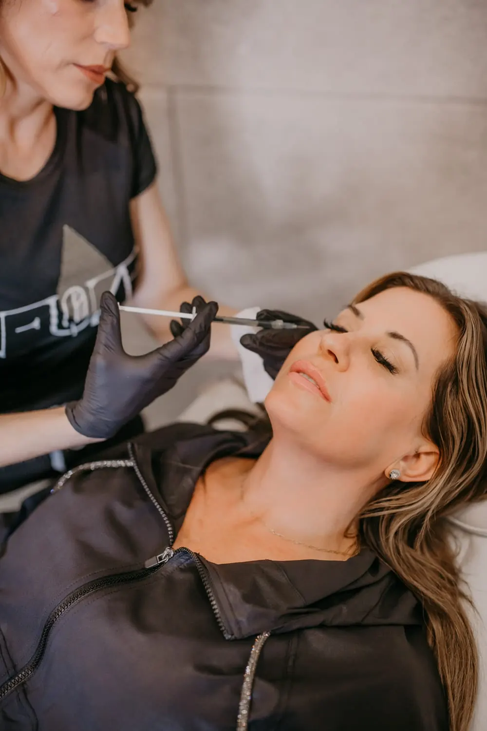 Microneedling with PRP or PDGF treatment at NFuze Wellness