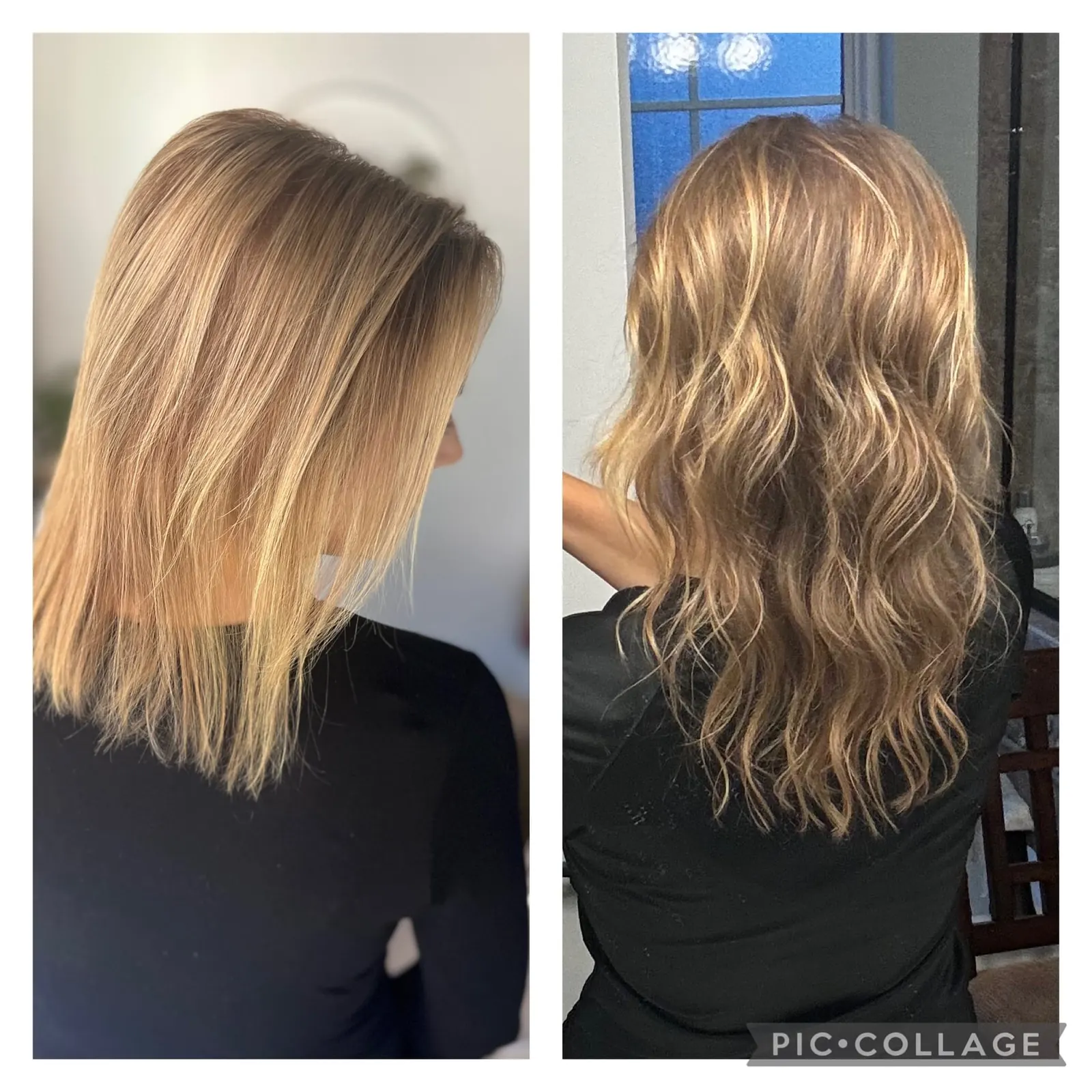 Hair Restoration at NFuze Wellness